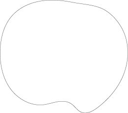 Polygon